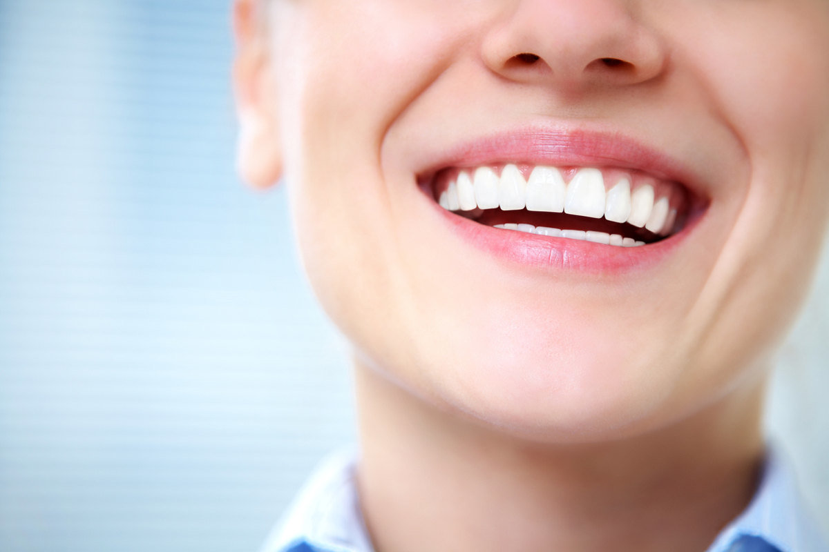 thumbnail image 2 of Temporary Teeth Veneers - 3 Sizes, 12 Positions, SL Ceramic For Anterior Whitening 2 of 10