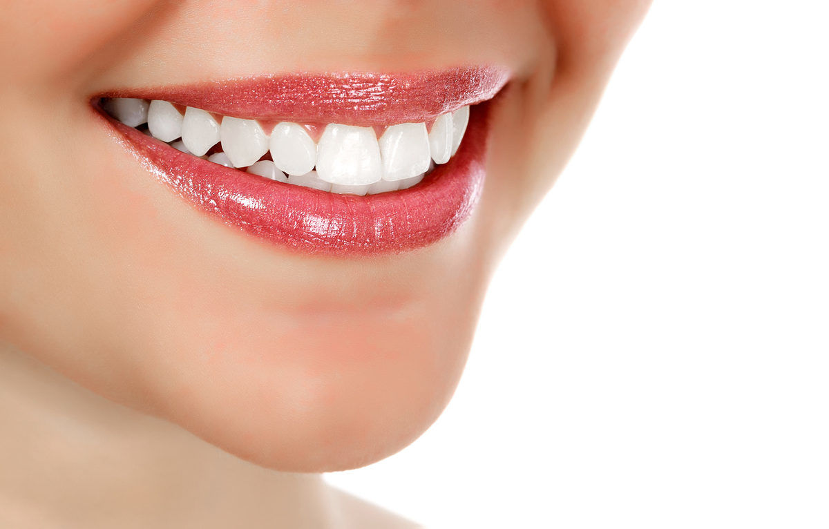 St Louis teeth whitening dentist