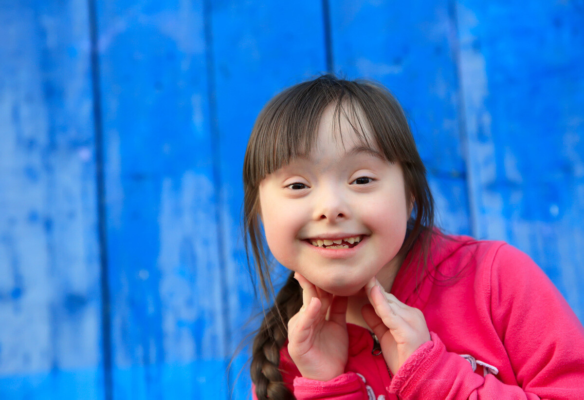 Special Needs Dentistry for Patients with Down Syndrome