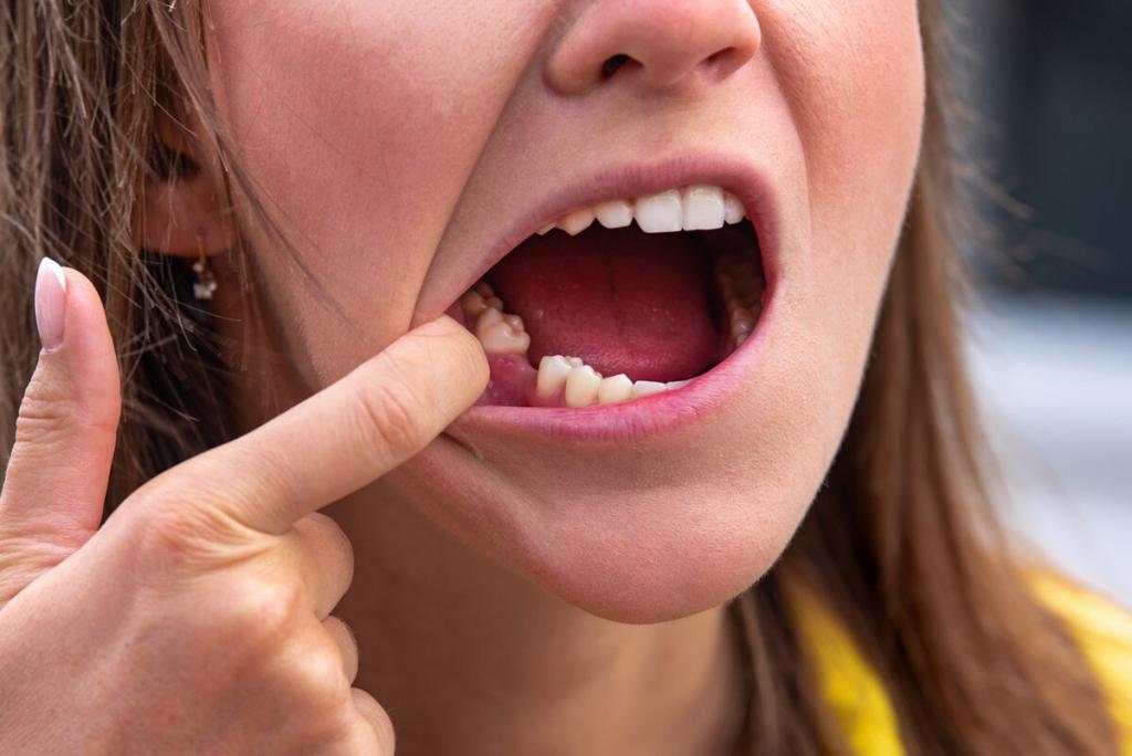 what-causes-tooth-loss