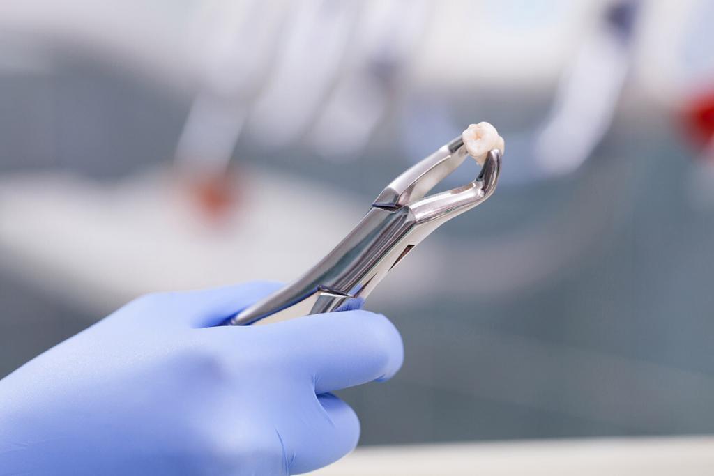 Sedation for Tooth Extraction
