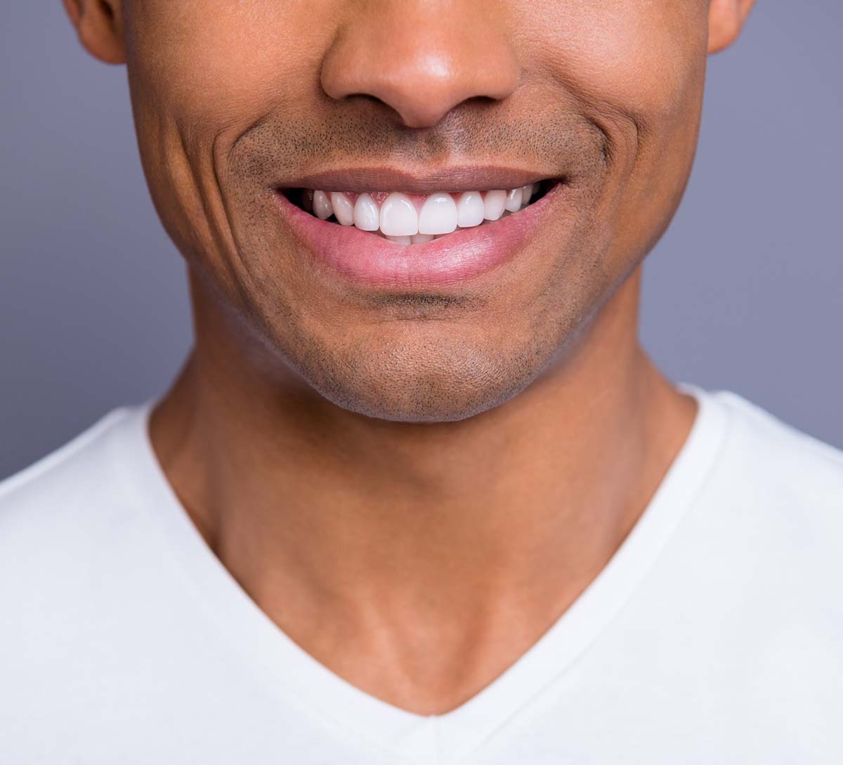 Teeth Whitening St. Louis